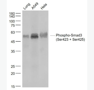 Anti-Phospho-Smad3 (Ser423 + Ser425) antibody-磷酸化细胞信号转导分子SMAD3重组兔单抗