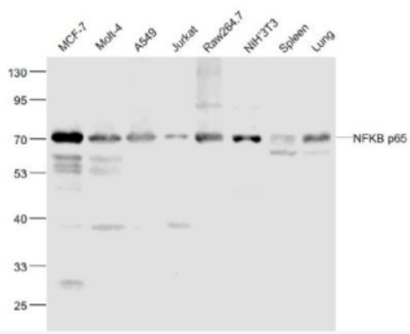 Anti-NFKB p65 antibody-细胞核因子/k基因结合核因子重组兔单抗
