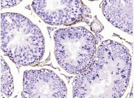 Anti-CD34  antibody-CD34重组兔单抗