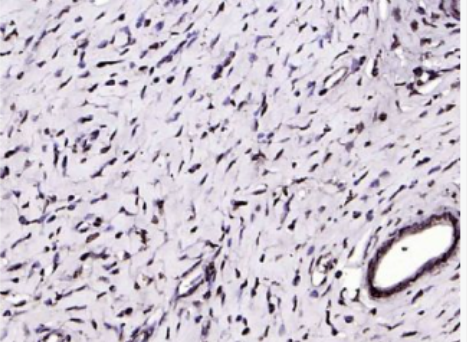 Anti-NOBOX antibody-同源盒蛋白NOBOX抗体