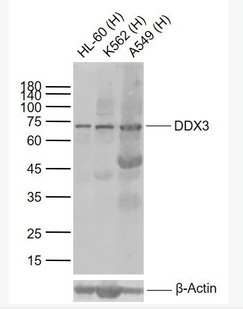 Anti-DDX3 antibody-三磷酸腺苷依赖解旋酶DDX3抗体
