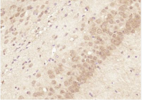 Anti-smooth muscle Myosin heavy chain 11 antibody-平滑肌肌球蛋白重链抗体