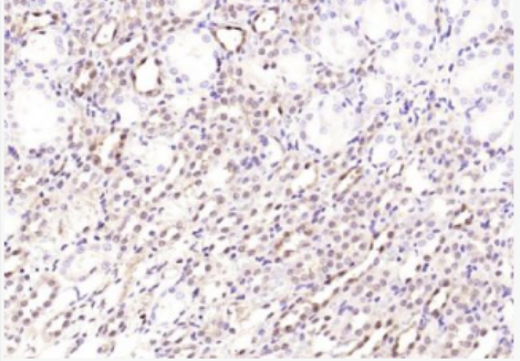 Anti-NT5C2 antibody-胞浆-5′-核苷酸酶-Ⅱ抗体