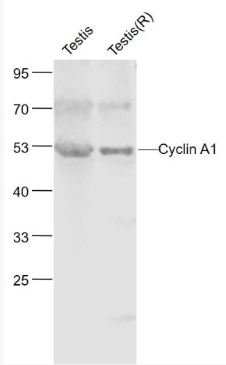 Anti-Cyclin A1 antibody-周期素A1蛋白抗体