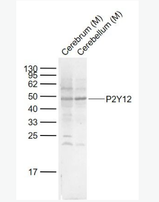 Anti-P2Y12  antibody-G蛋白偶联嘌呤受体p2y12抗体