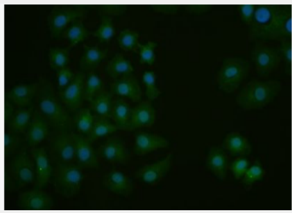 Anti-CEBP-alpha antibody-转录调节因子C/EBP α 抗体