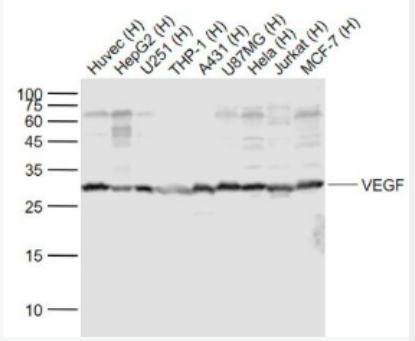 Anti-VEGF antibody-血管内皮生长因子抗体