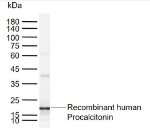 Anti-Procalcitonin (PCT)antibody-降钙素原单克隆抗体
