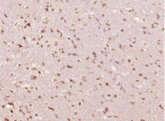 Anti-phospho-STAT6 (Tyr641) antibody-磷酸化信号转导和转录激活因子6抗体