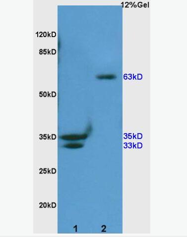 Anti-phospho-SHC1 (Ser36) antibody-磷酸化SH2结构域转化蛋白1抗体