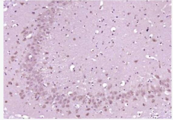 Anti-Phospho-PKA alpha + beta (Thr198) antibody-磷酸化蛋白激酶C亚性抗体