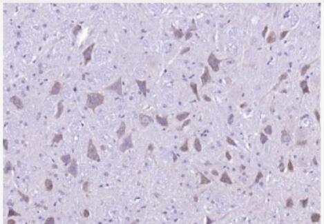 Anti-Phospho-NMDAR2A (Tyr1325) antibody-磷酸化谷氨酸受体2A抗体