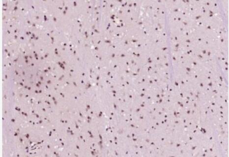 Anti-Phospho-NFKB1 (Ser932) antibody-磷酸化细胞核因子p50/k基因结合核因子抗体