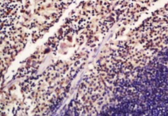 Anti-Phospho-SATB1 (Ser47) antibody-磷酸化核基质结合区结合蛋白1抗体