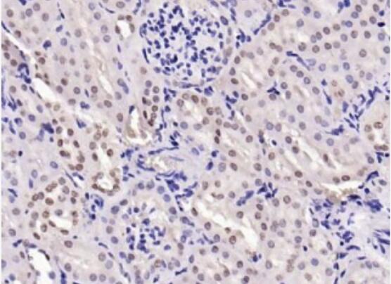 Anti-Phospho-LATS1 (Ser909) antibody-磷酸化肿瘤抑制基因LATS1抗体