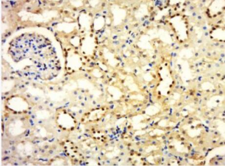 Anti-Phospho-HER2 (Tyr877) antibody-磷酸化HER2受体抗体