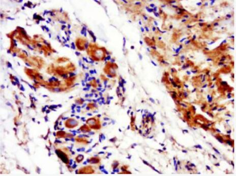 Anti-Phospho-Connexin 43 (Ser368) antibody-磷酸化Connexin 43蛋白抗体