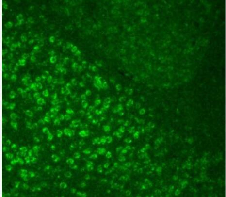 Anti-Phospho-GCN2 (Thr899) antibody-磷酸化蛋白激酶GCN2蛋白抗体