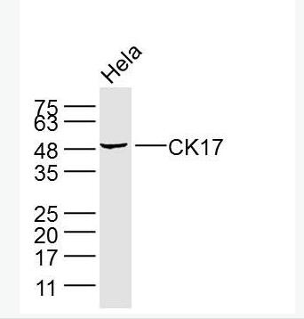 Anti-CK17 antibody-细胞角蛋白17单克隆抗体.
