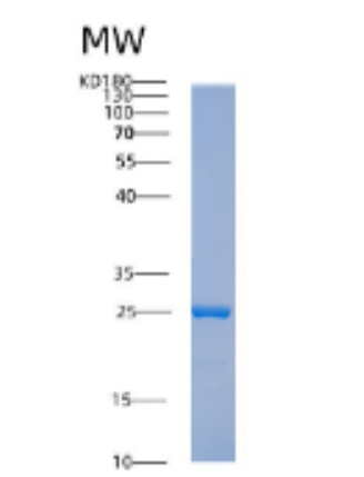 Recombinant Human ABHD14B Protein