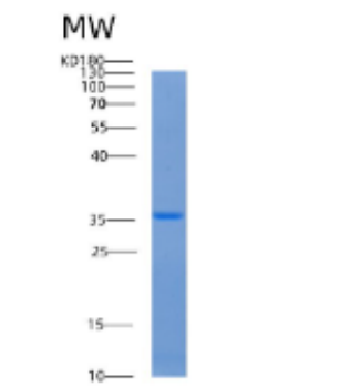 Recombinant Human AASDHPPT Protein