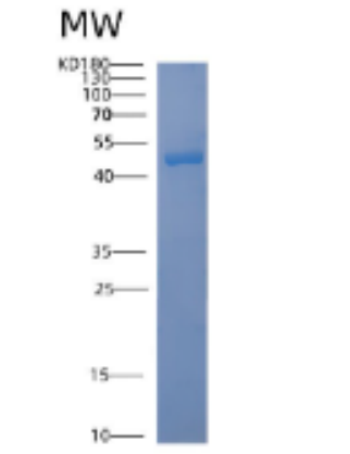 Recombinant Human ACAD8 Protein