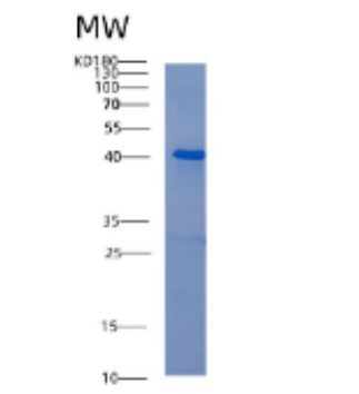 Recombinant Human ABI3 Protein