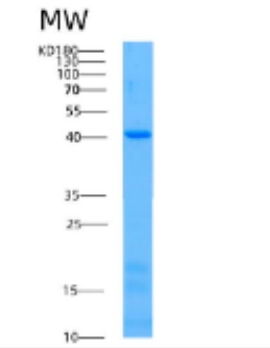 Recombinant Human ACAA1 Protein