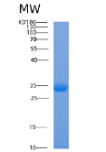 Recombinant Human ABHD12B Protein