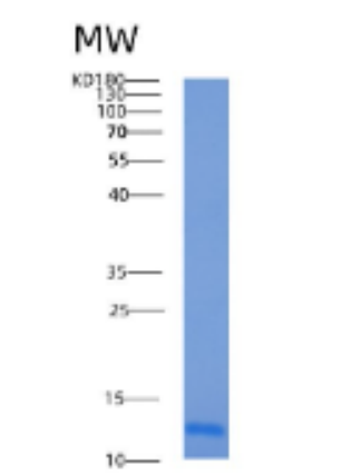 Recombinant Human ACBP Protein