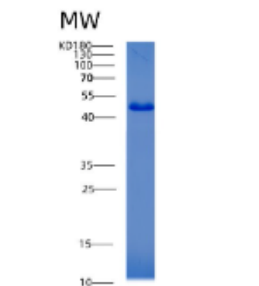 Recombinant Human ACAT2 Protein