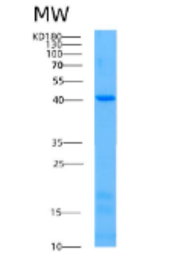 Recombinant Human ACAA2 Protein