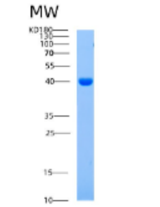 Recombinant Human AIMP1 Protein