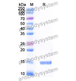 Anti-Human ANGPT1 Nanobody (SAA1256)