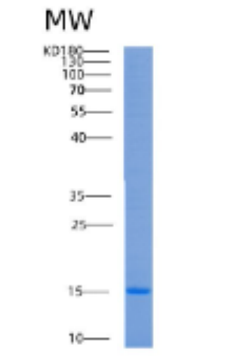 Recombinant Human AGRP Protein
