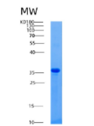 Recombinant Human AGA Protein