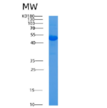 Recombinant Human ADA Protein