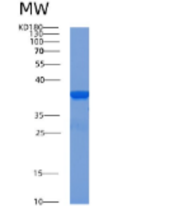 Recombinant Human ACOT8 Protein