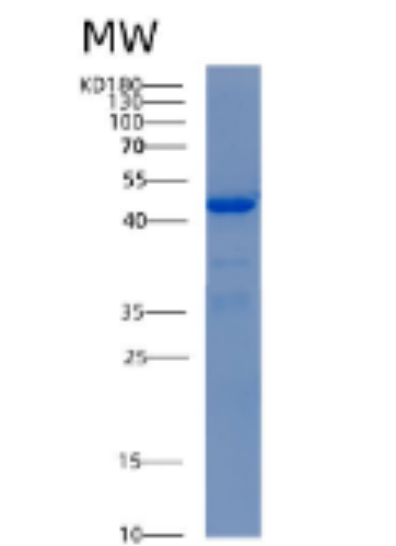 Recombinant Human ADH5 Protein