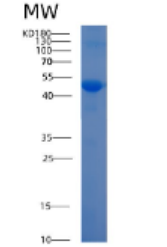 Recombinant Human ADAM10 Protein