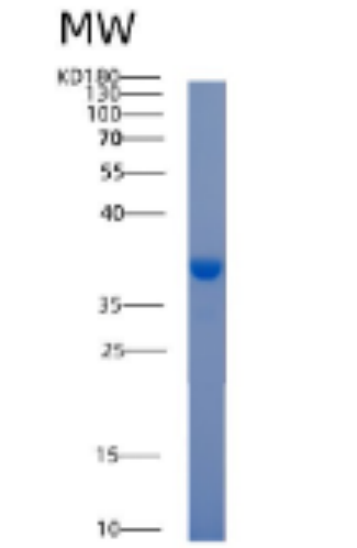 Recombinant Human ACY3 Protein