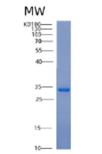 Recombinant Human ACTN1 Protein