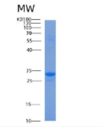 Recombinant Human ACBD6 Protein