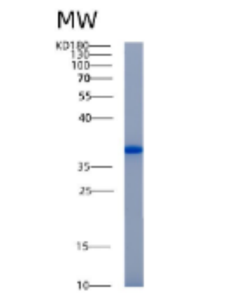 Recombinant Human AKR1B10 Protein
