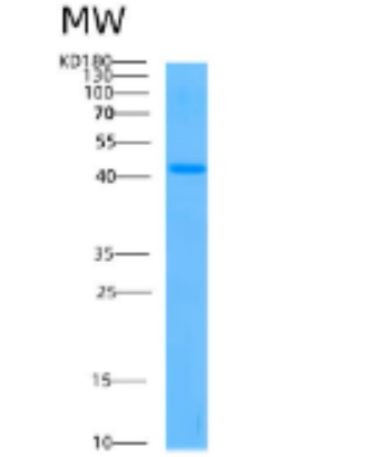 Recombinant Human ADH1A Protein