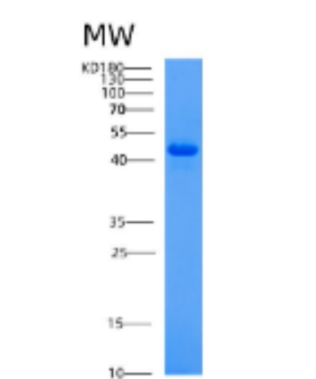Recombinant Human ACP2 Protein