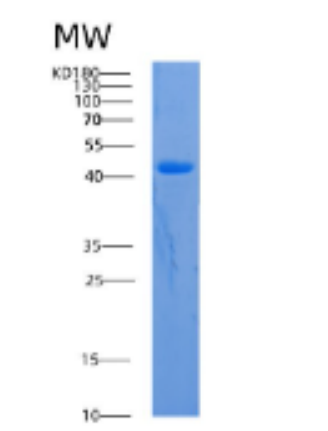 Recombinant Human ACADM Protein