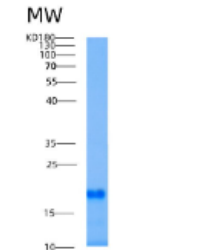Recombinant Human AIF1L Protein