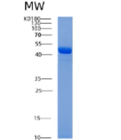 Recombinant Human ADRM1 Protein