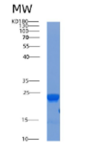 Recombinant Human Acid phosphatase 1 Protein